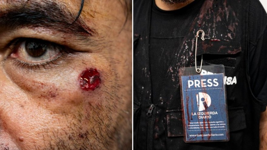 Brutal repressió a l'Argentina: periodistes ferits i un advocat del Frente de Izquierda en perill de perdre l'ull