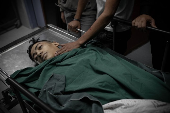 Imatge de Mohamen Yassin Jaber moments després del seu decés a l'hospital d'Hebrón. Mort per un tret amb munició real de l'exèrcit d'Israel en el transcurs d'unes protestes contra els atacs a Gaza. Foto: Caterina Albert